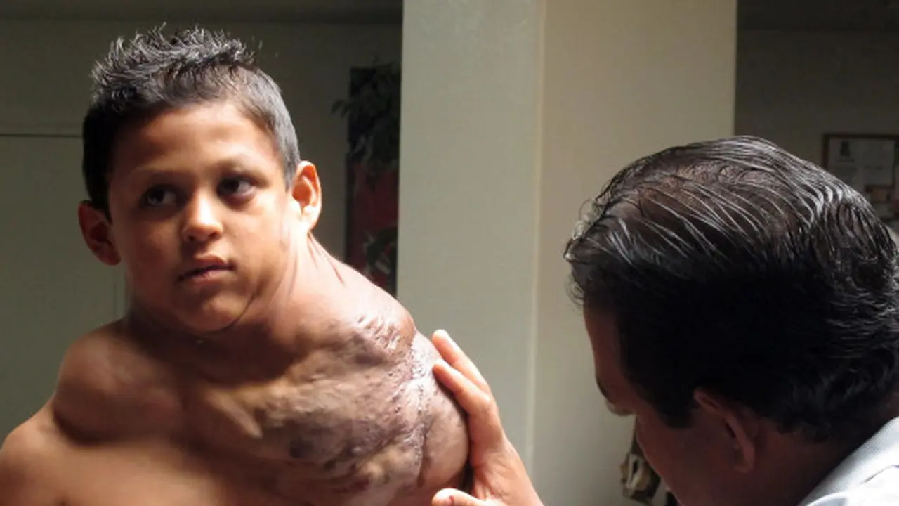 Seorang anak 11 tahun dari Ciudad Juarez, Meksik