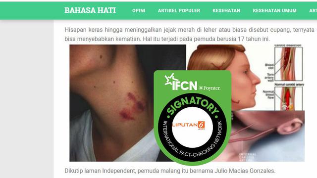 Cek Fakta - Cupang bisa memicu stroke dan kematian?
