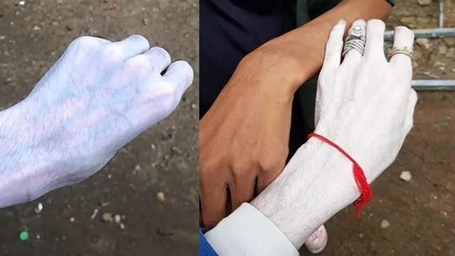 Hasil krim pemutih
