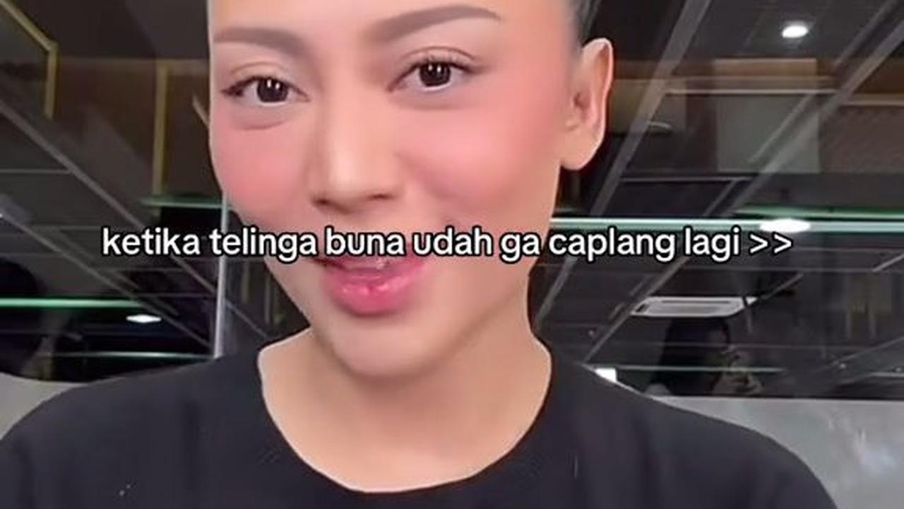 Rachel Vennya Perlihatkan Kuping Baru, Akui Merasa Bahagia Tak Caplang Lagi: Mungkin Pas Lagi 'di Pabrik' Lupa Dijahit