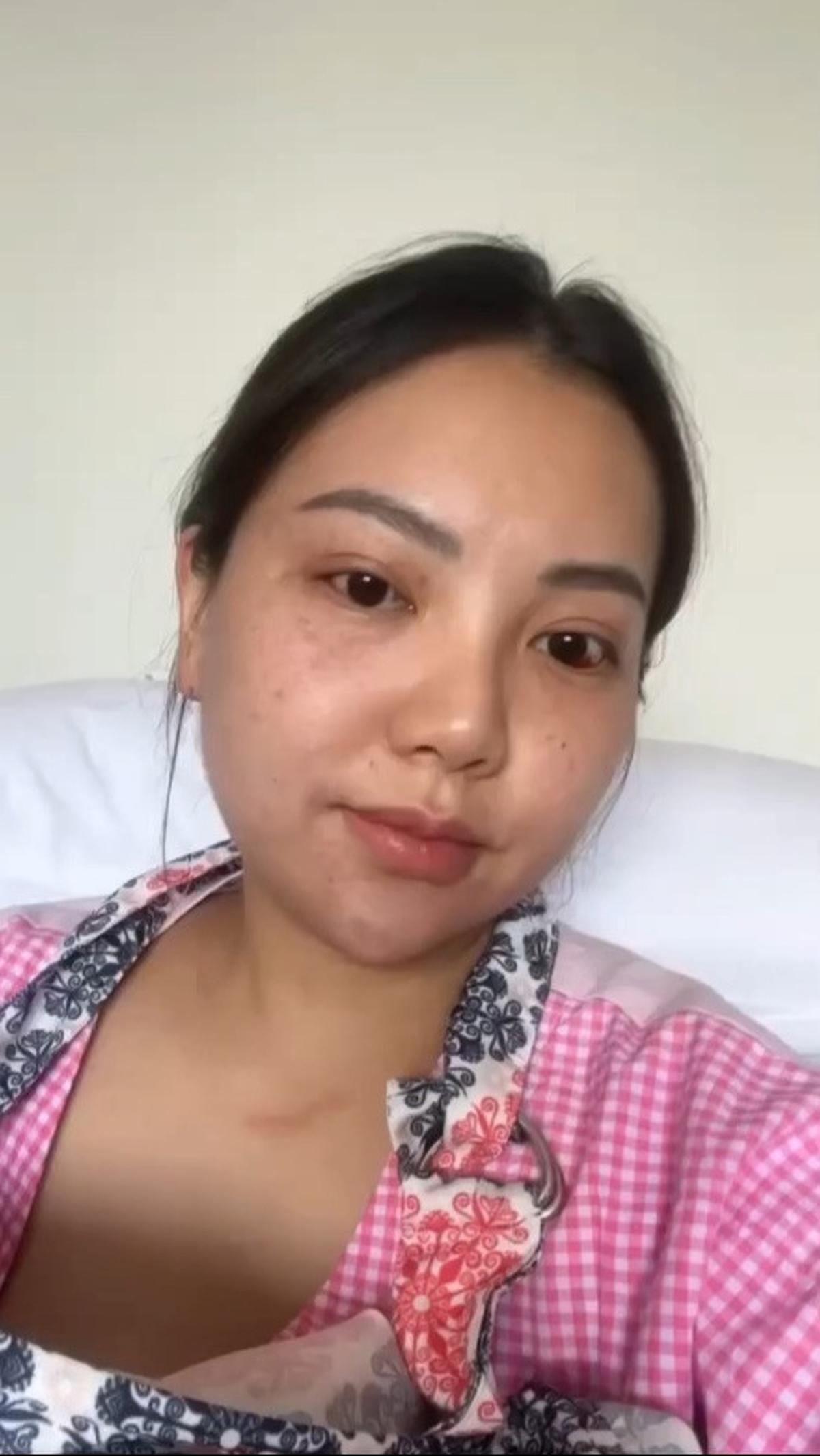 YouTuber dan pengusaha Tya Magdalena dikabarkan sempat mengalami pecah pembuluh darah saat melahirkan. Perempuan yang akrab dipanggil Pao Pao ini mengalami pecah pembuluh darah lantaran diduda salah mengejan.