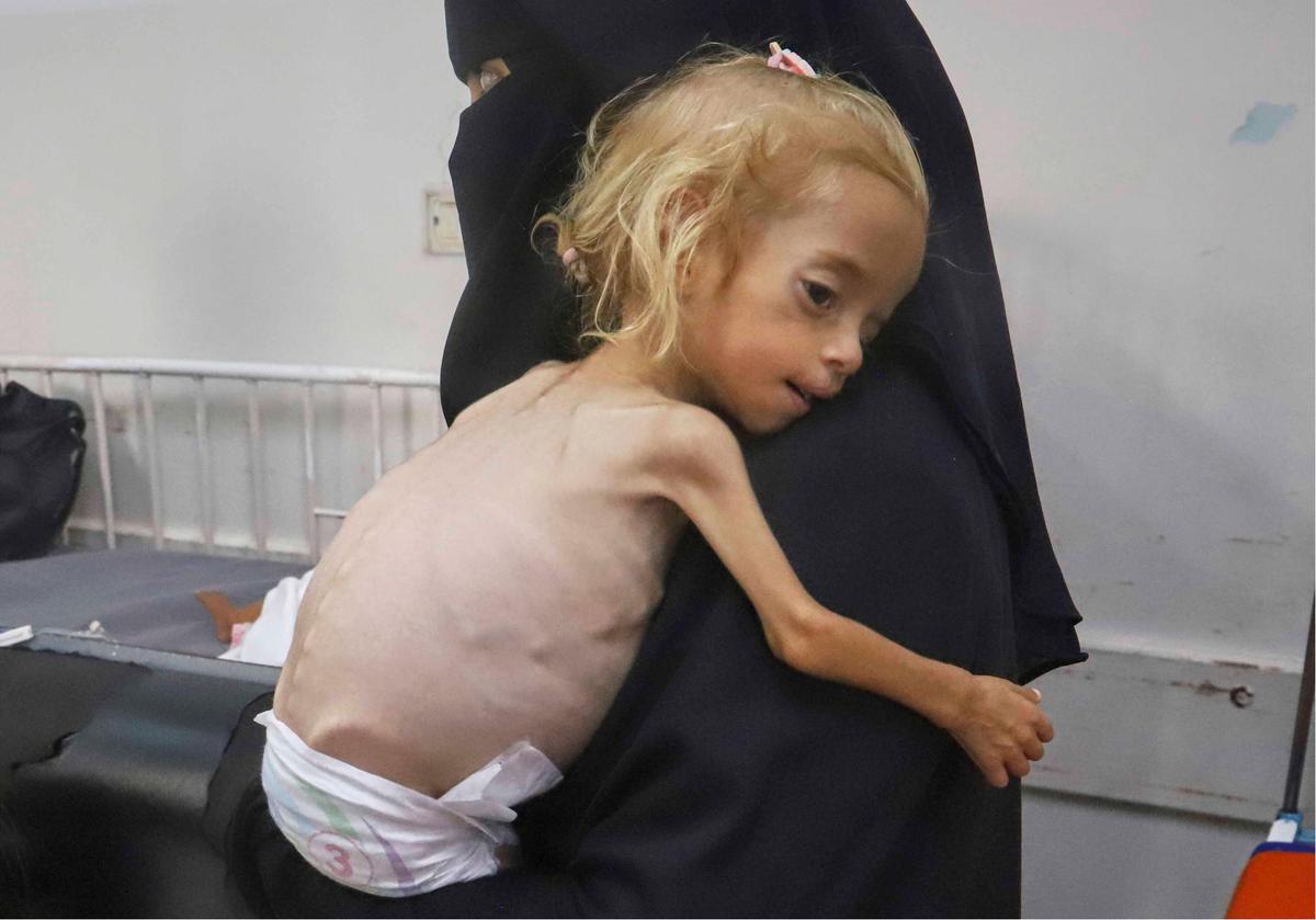 FOTO: Dari Gaza ke Italia, Perjuangan Kecil Shamm Qudeih
