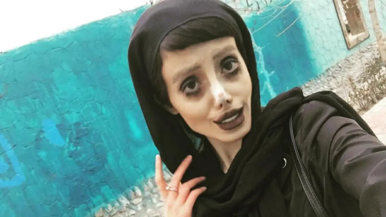 Gadis Iran Tempuh 50 Operasi Plastik Agar Mirip Angelina Jolie