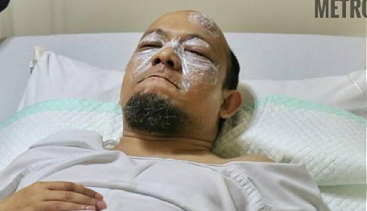 Novel Baswedan saat dirawat di Rumah Sakit Mitra Keluarga Kelapa Gading, Jakarta Utara, Selasa (11/4). Penyidik senior KPK tersebut menjadi korban penyiraman air keras saat pulang Salat Subuh. (Instagram/@spripimpoldametro)