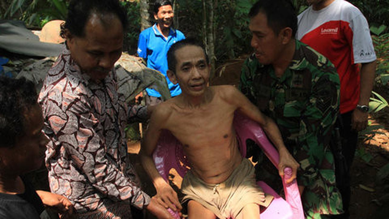 24 Tahun hidup dipasung, Dartam akhirnya dibawa ke RSUD Banyumas