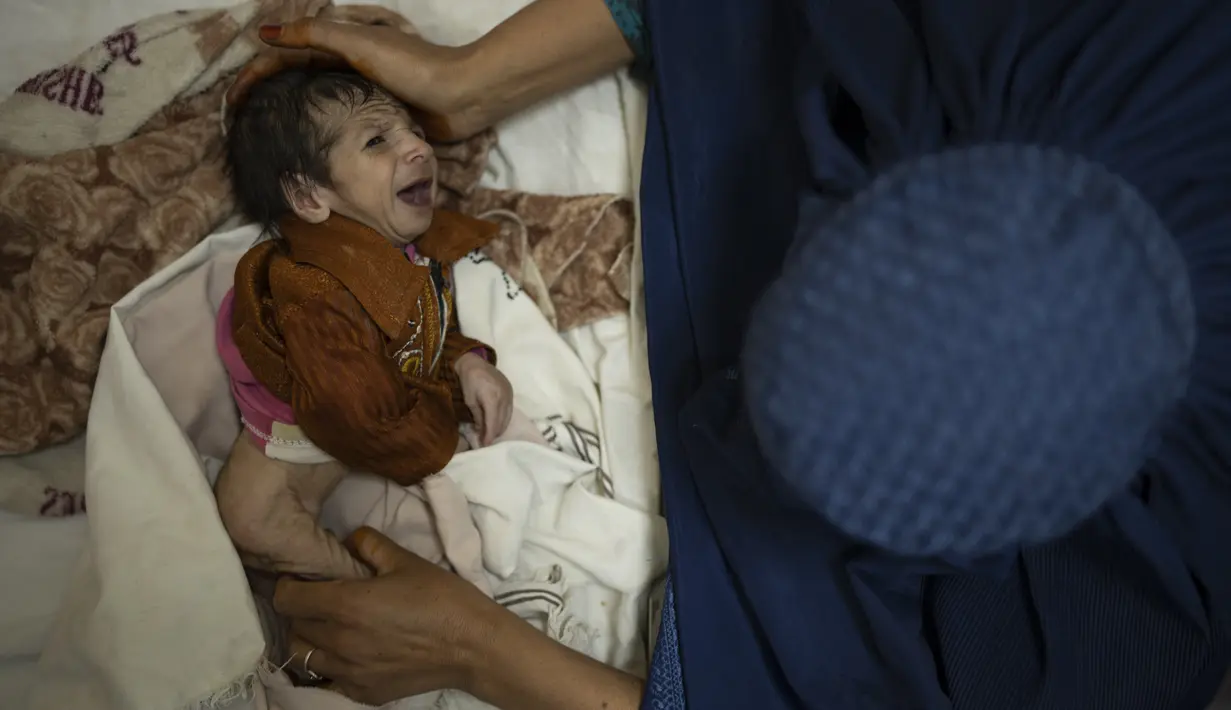 Sofia menggendong bayinya, Abdul (2 bulan), saat menjalani perawatan di bangsal gizi buruk Rumah Sakit Anak Indira Gandhi di Kabul, Selasa (5/10/2021). Petugas kesehatan di rumah sakit itu berlari mondar-mandir merawat bayi prematur dan yang lainnya menderita kekurangan gizi parah. (AP/Felipe Dana)