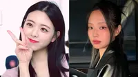 Tren Kecantikan Terbaru Short Midface ala Korea, Apakah Itu?