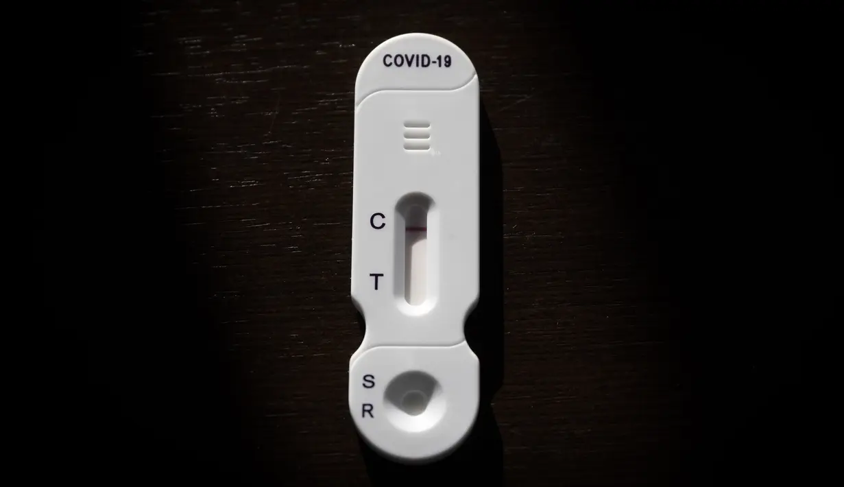 Tes COVID-19 digambarkan di NG Biotech, start-up pembuat berbagai tes medis, termasuk kit COVID-19, di Guipry, Prancis pada 7 Januari 2022. Prancis memecahkan rekor infeksi harian tertinggi di Eropa membuat produsen bekerja keras memenuhi permintaan besar untuk tes. (AP Photo/Jeremias Gonzalez)