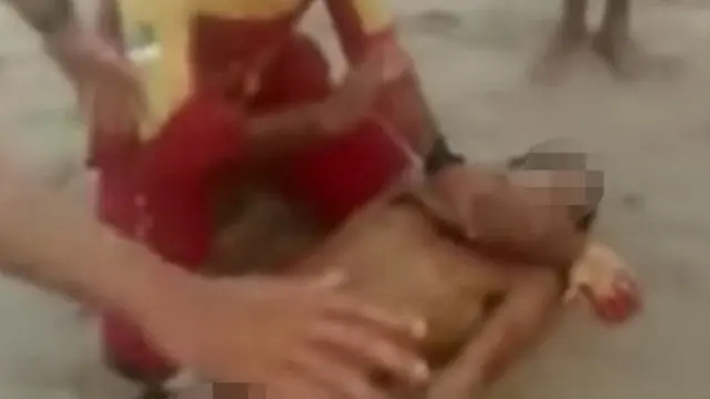Remaja Tewas Setalah Kehilangan Penis Akibat Gigitan Hiu