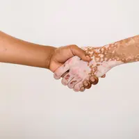 Berikut 3 jenis penyakut autoimun yang kerap muncul selama pandemi Covid-19. (pexels/armin rimoldi).