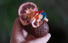 Waspada! Diabetes Tak Hanya Terkait Gula, Tapi Bisa Sebabkan Dua Jenis Batu Tubuh