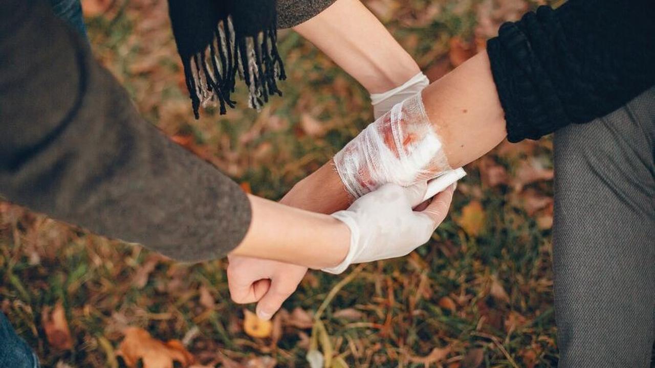 17. Sembuhkan Luka Bakar dengan Keajaiban Tanin