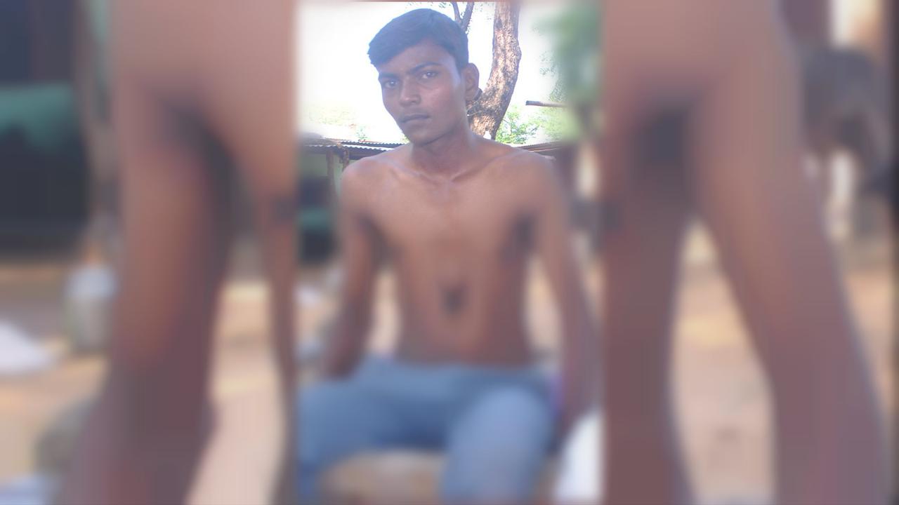 Kisah Pemuda yang Terlahir dengan Jantung di Luar Tubuh