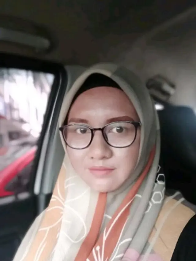 Viral, Wanita Ini Alami Perubahan Wajah Seperti Nenek-nenek Saat Hamil