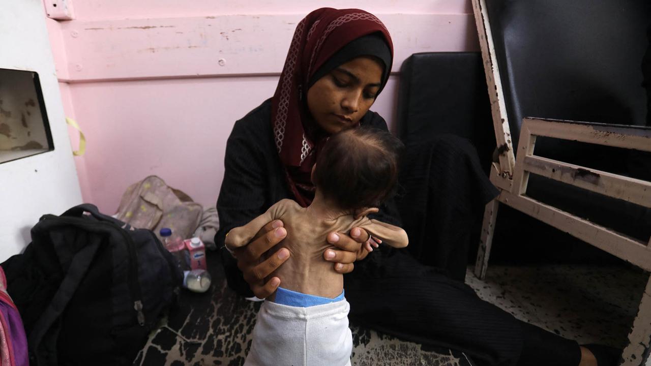 FOTO: Tubuh Kecil yang Lapar, Potret Pedih Bayi Gaza di Tengah Ancaman Kelaparan Massal