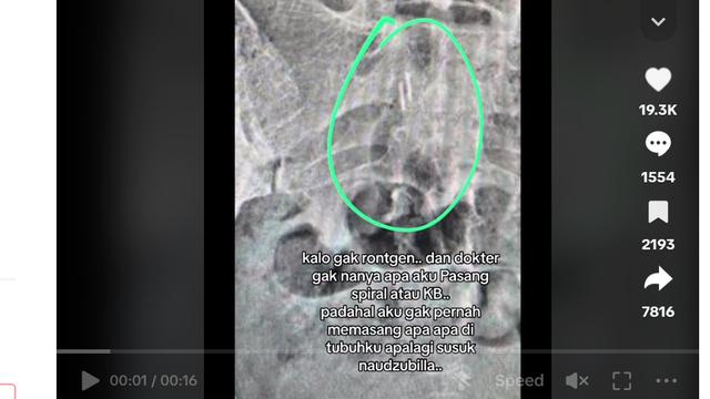 Stevie Agnecya Meninggal Dunia, Sempat Ungkap Dikirimi Santet