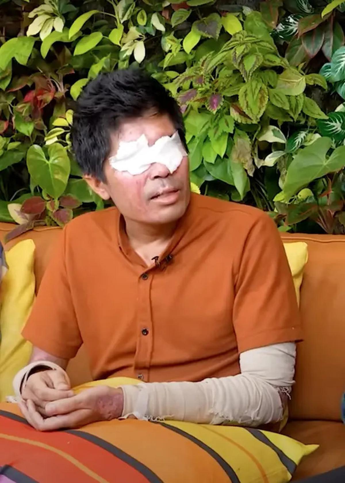 Uang Donasi Agus Salim Akhirnya Didonasikan untuk Korban Bencana Alam di Lewotobi, Ini Fakta di Baliknya