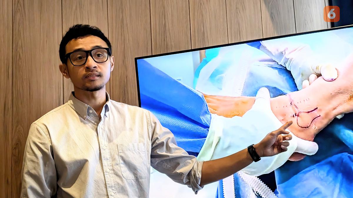 Bak Tradisi Lotus Foot dari China, Indonesia Juga Punya Budaya High Heels