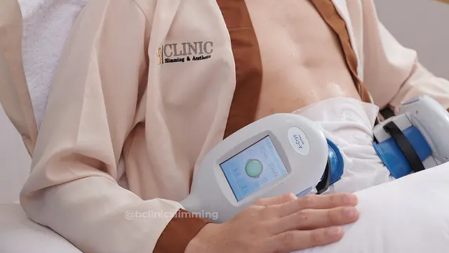 Cara Baru Mendapatkan Tubuh Ideal dengan Pembekuan Lemak