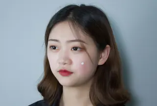 Masalah breakout pada kulit./copyright unsplash/shali