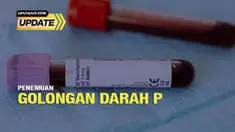 Sebuah rumah sakit di Provinsi Jiangsu, China baru-baru ini menemukan adanya urutan genetik baru untuk golongan darah langka tipe P. Diketahui temuan tersebut menjadi kasus yang langka karena golongan darah tipe P merupakan golongan darah yang sangat...