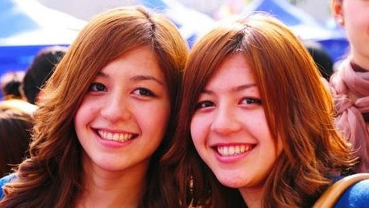 Gadis kembar China kompak barengan ganti kelamin