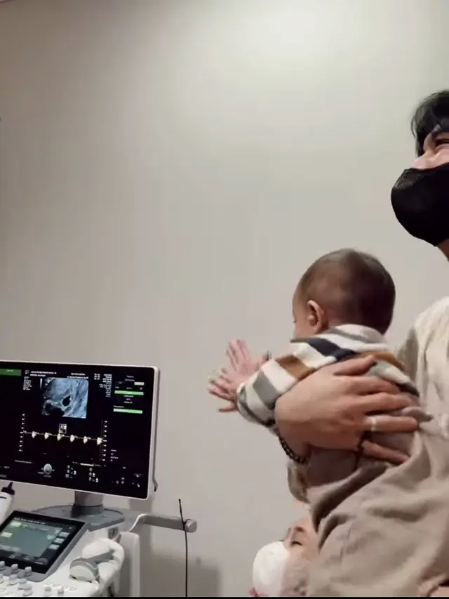 Dinda Hauw Keguguran Anak Kembar