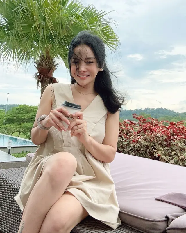 6 Potret terbaru Mawar AFI usai operasi plastik habiskan Rp521 Juta 