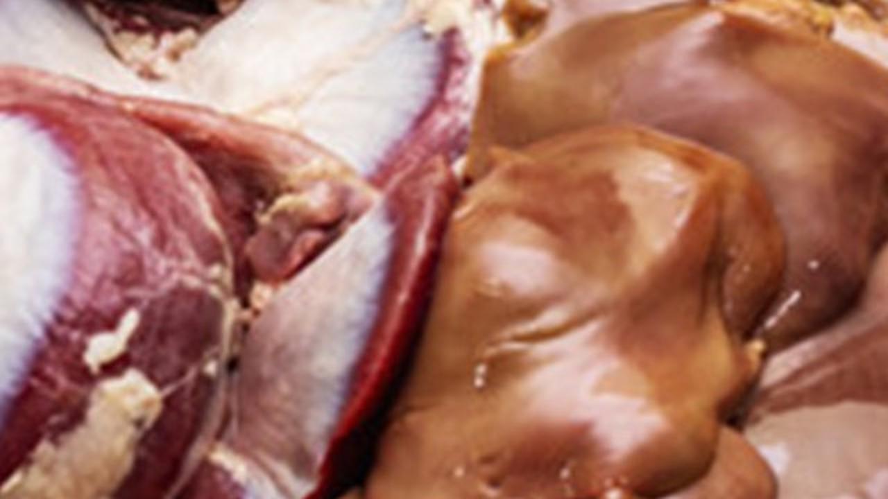 Kolesterol Tinggi? Ini 6 Makanan yang Dapat Meningkatkan Risiko Penyakit Jantung