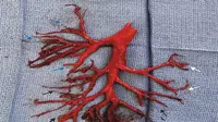 Gumpalan darah terbentuk di pohon bronkial pasien yang gagal jantung kronis. (The New England Journal of Medicine)