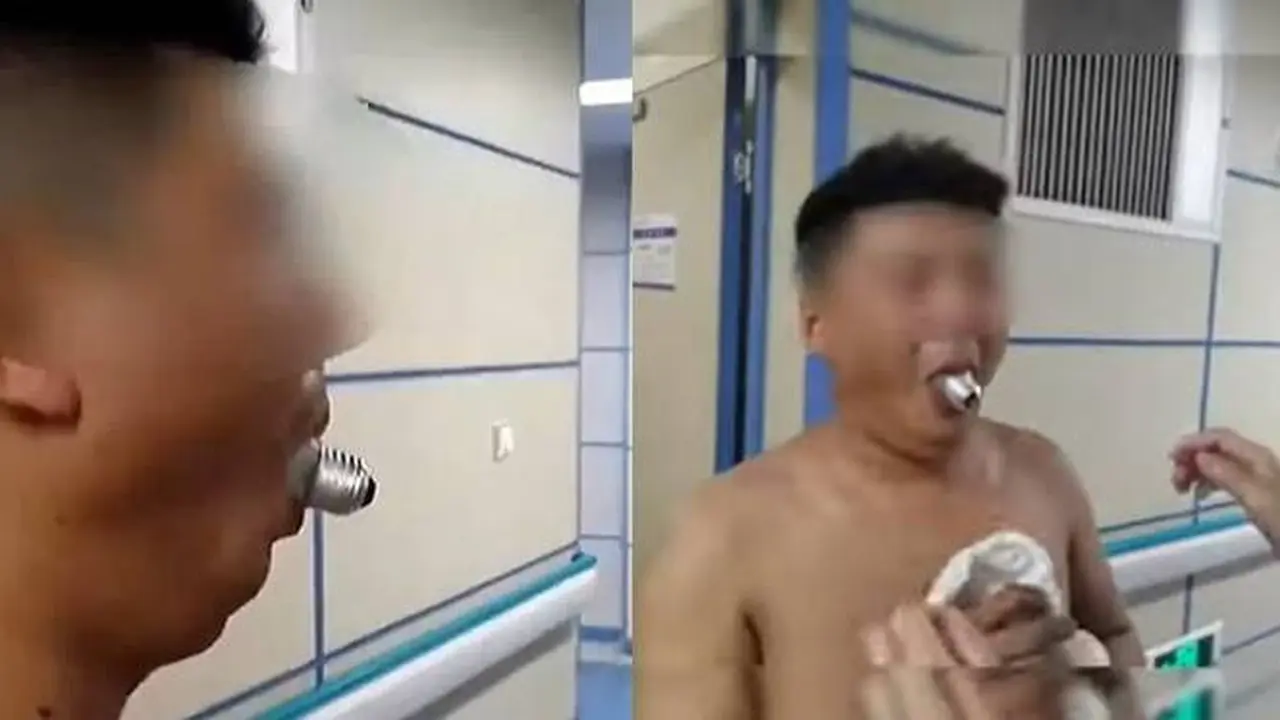 Ikuti Tantangan Nyeleneh, Pria Ini Malah Apes Bohlam Lampu Nyangkut di Mulutnya