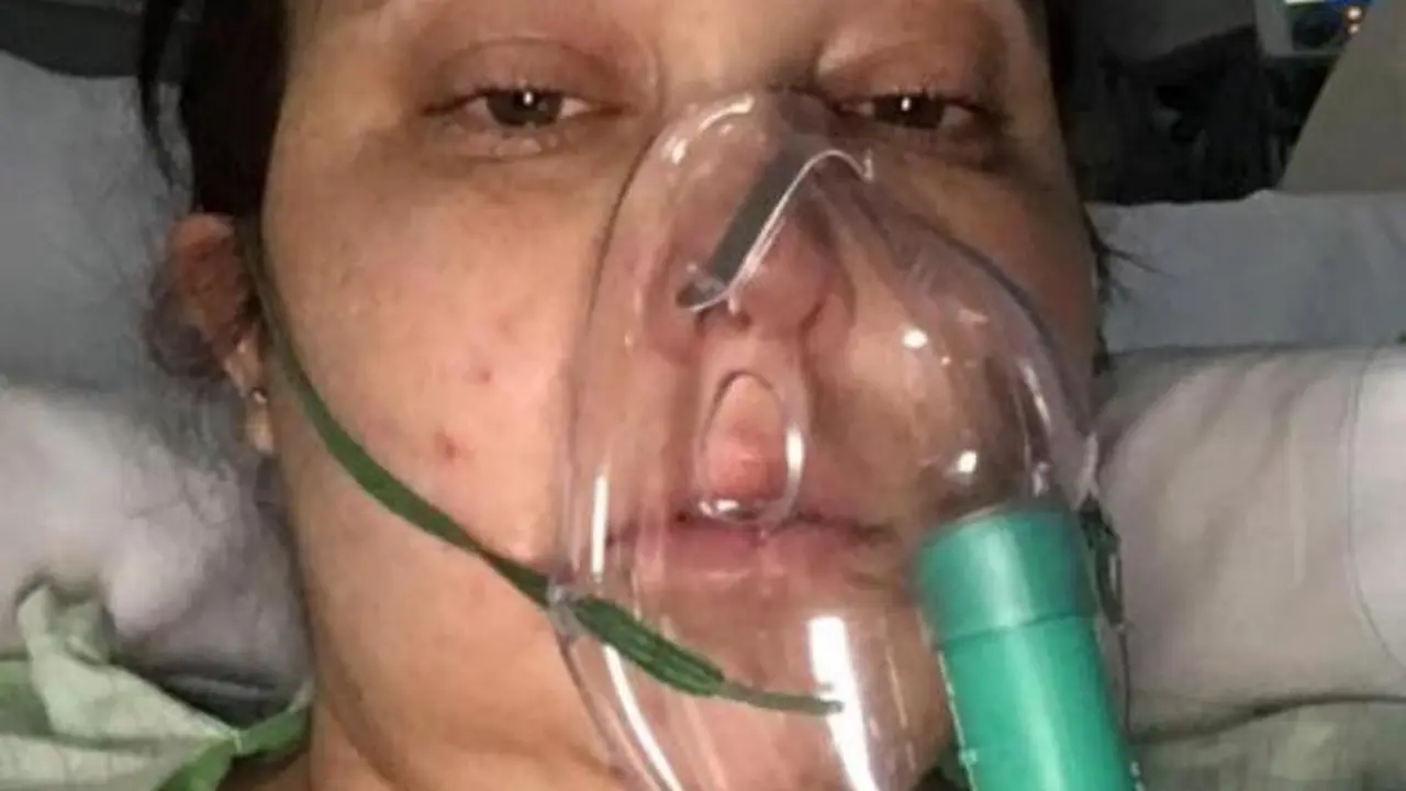Karena Tumor Otak, Berat Model Bikini Naik 19 Kg!