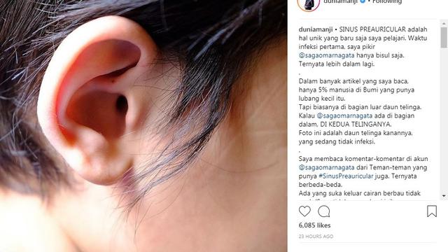 Anji (Foto: Instagram)