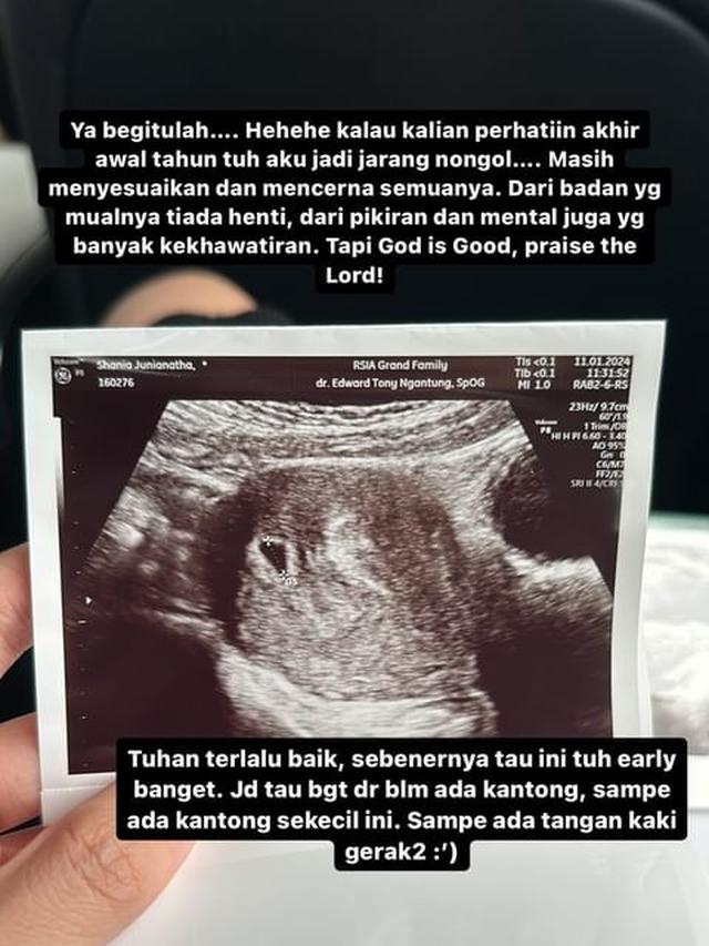 7 Potret Jonatan Christie dan Shanju Umumkan Hamil Anak Pertama, Penuh Kebahagiaan