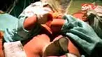 Seorang ibu di Gresik, Jatim, melahirkan bayi kembar siam dempet perut. Bayi laki-laki buah cinta Dian Pitoyo dan Afifah itu kini dirujuk ke RS Dokter Sutomo, Surabaya, Jatim. 