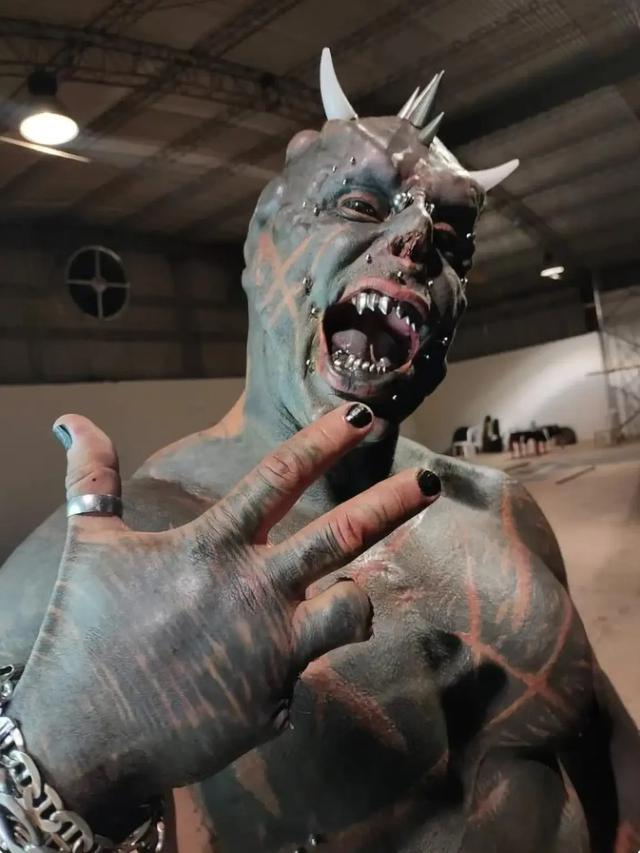 Pria Ini Jalani Operasi untuk Mengubah Tangan Jadi Cakar