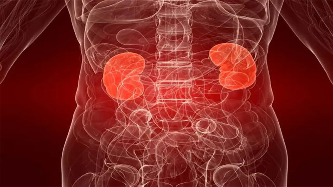 Transplantasi Ginjal