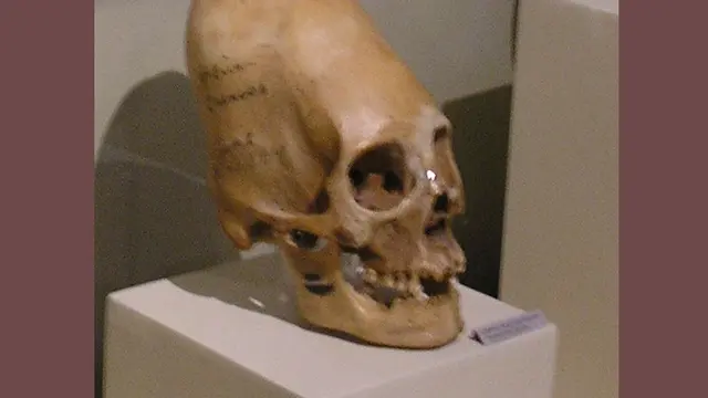 Ilustrasi Kepala Kerucut. (Sumber: Paracas Skulls Ica Museum via Wikipedia Commons/Public Domain)