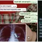 Chat Prank Sakit ke Teman. (Sumber: Twitter/@nocontxtnetijen dan Twitter/@verasitipariha1)