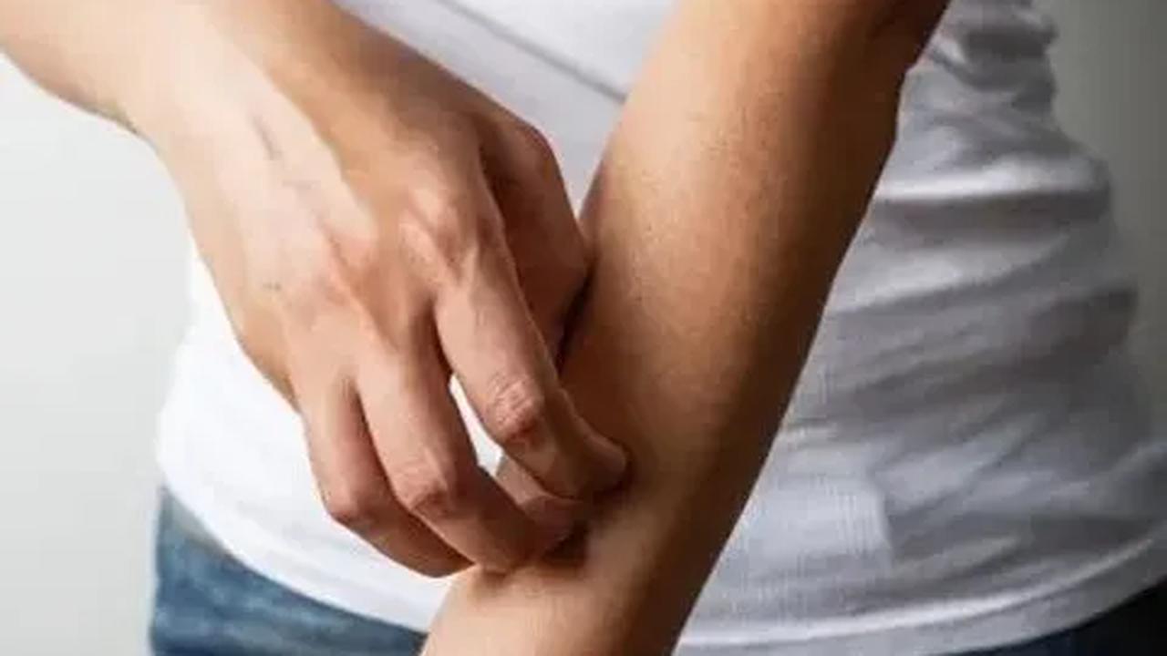 Luka Hampir Sembuh
