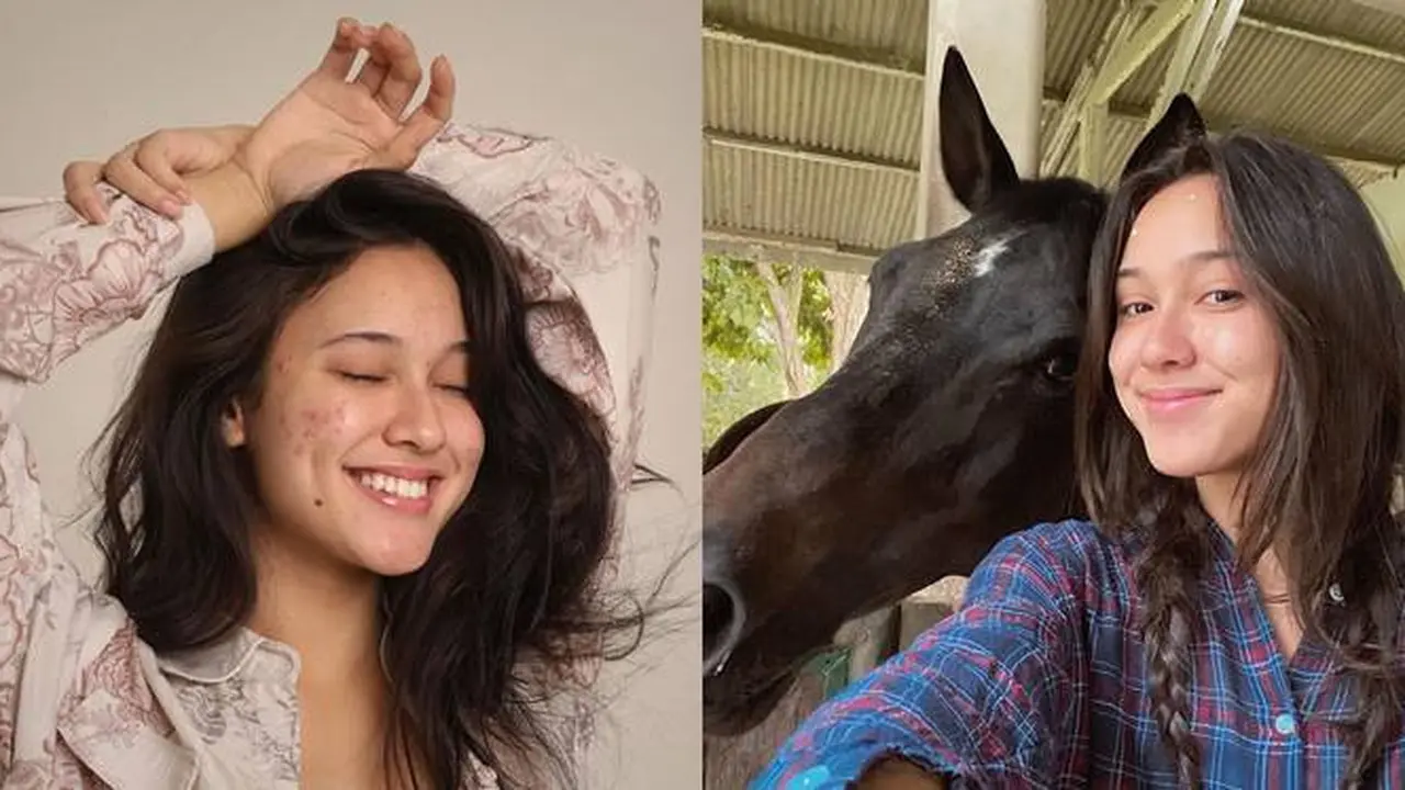 Pamer Wajah Berjerawat, Ini 7 Potret Yasmin Napper dengan Makeup Natural