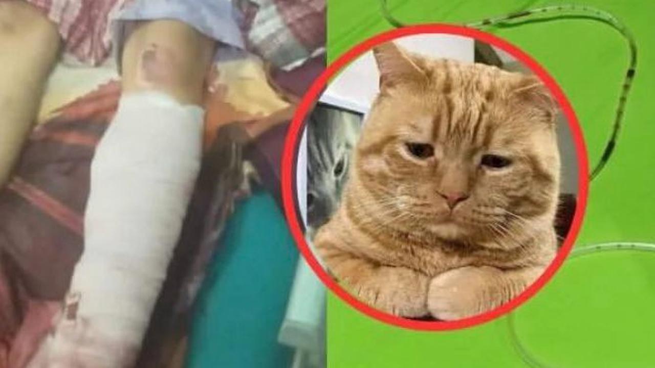 Kisah Viral Bocah Nabila Febrianti, Kaki Diamputasi Gara-Gara Selamatkan Kucing dari Kecelakaan