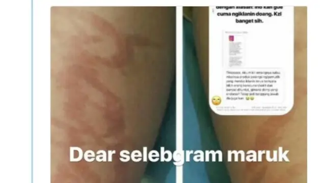 hati-hati jika pakai lotion pemutih (brilio/twitter @nuruliu)