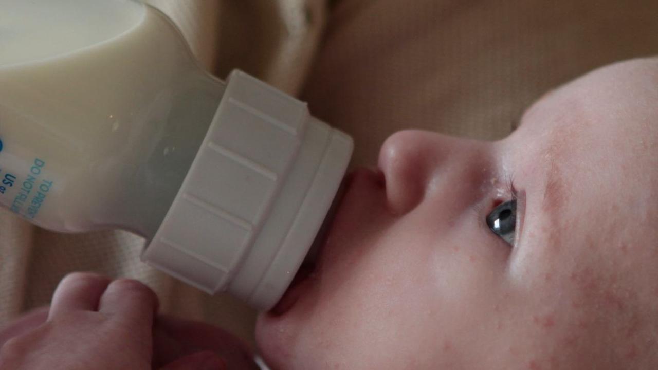 <b>Ciri-Ciri Alergi Susu Sapi pada Anak</b>