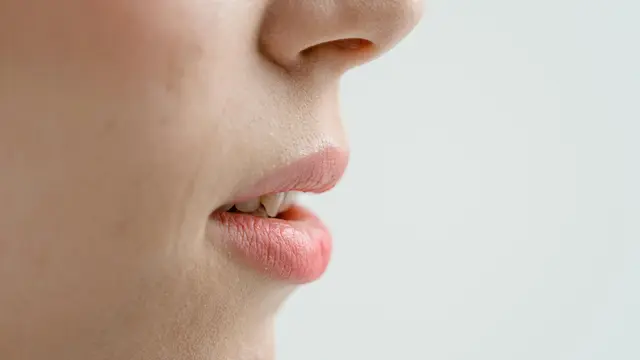 Bibir Kering