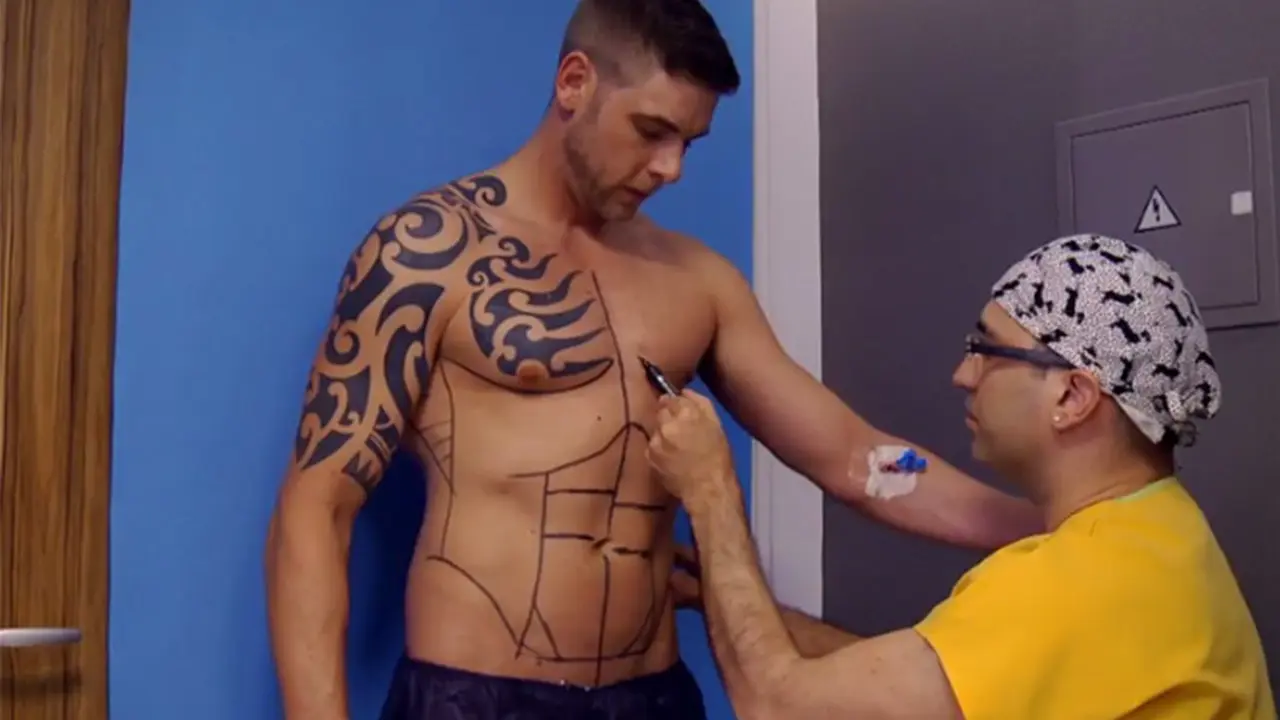Malas diet, Pria Ini Pilih Operasi Agar Six Pack