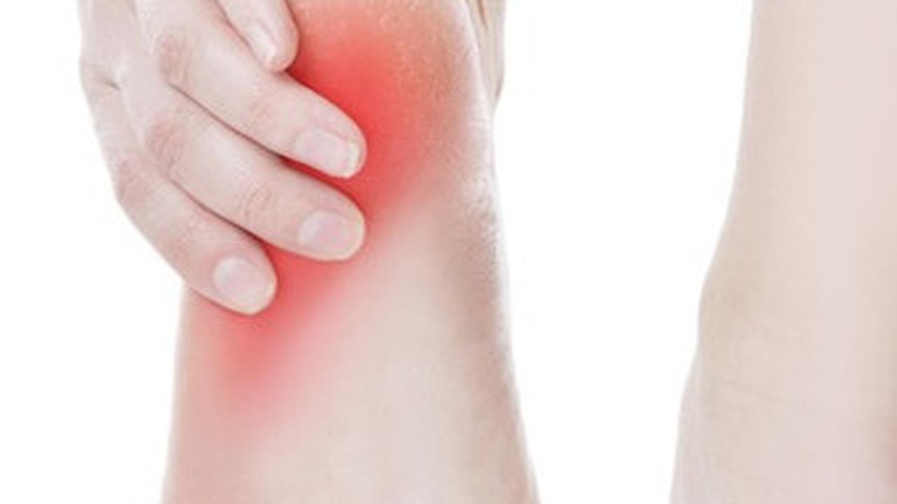 plantar fasciitis