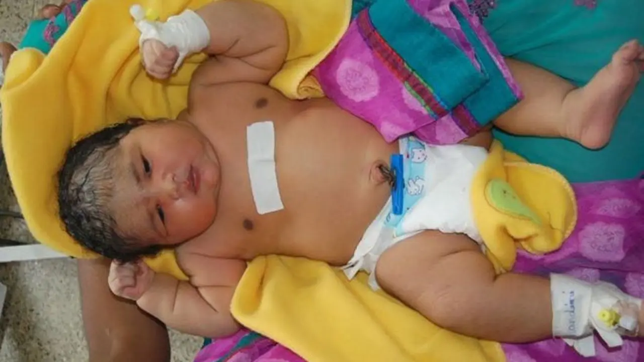 Lahirkan Bayi Seberat 6,7 Kg, Wanita India Ini Butuhkan 15 Menit
