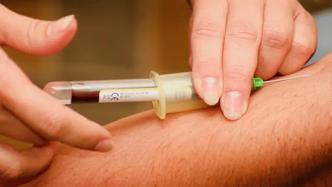 10 Manfaat Daun Bidara untuk Kesehatan Tubuh, Bantu Turunkan Kolesterol hingga Gula Darah