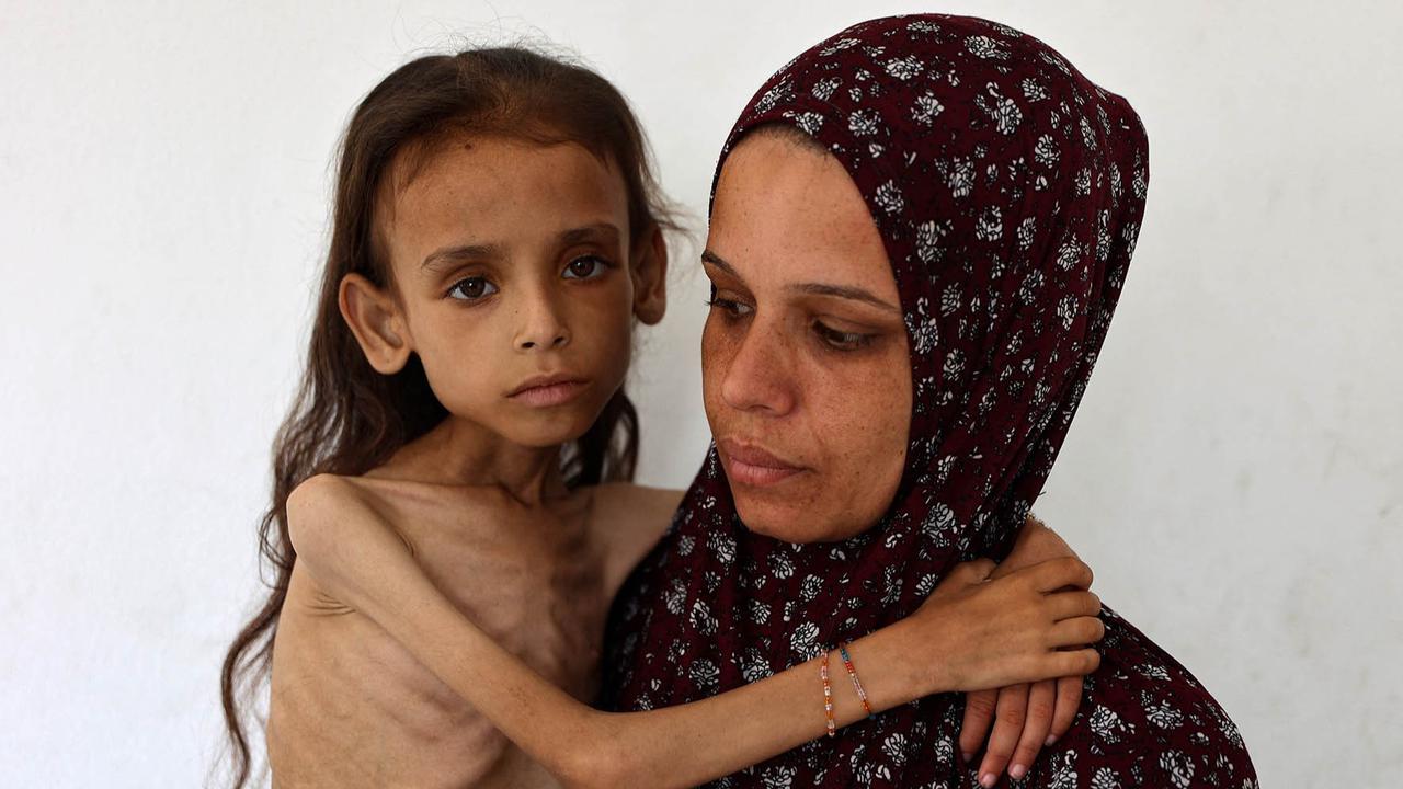 FOTO: Potret Pedih Mariam Anak 9 Tahun, Korban Kelaparan Gaza